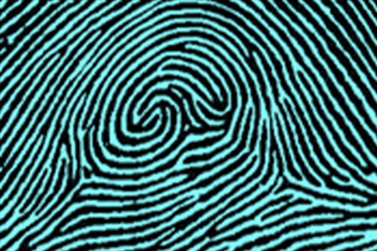 Accidental types of fingerprints